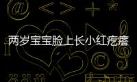 两岁宝宝脸上长小红疙瘩怎么办