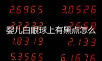 婴儿白眼球上有黑点怎么回事呢