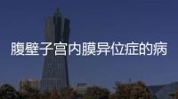 腹壁子宫内膜异位症的病因